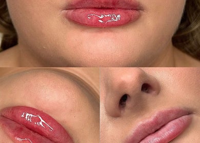 Close-up of enhanced lips at Megan Bond Aesthetics, Astley Cross, England, GB, showcasing expert beauty care.