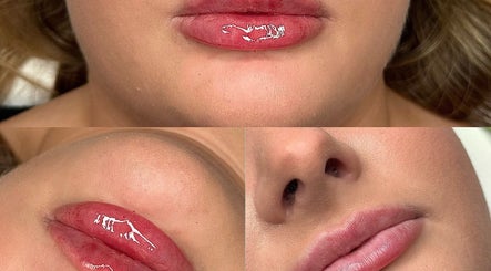 Close-up of enhanced lips at Megan Bond Aesthetics, Astley Cross, England, GB, showcasing expert beauty care.