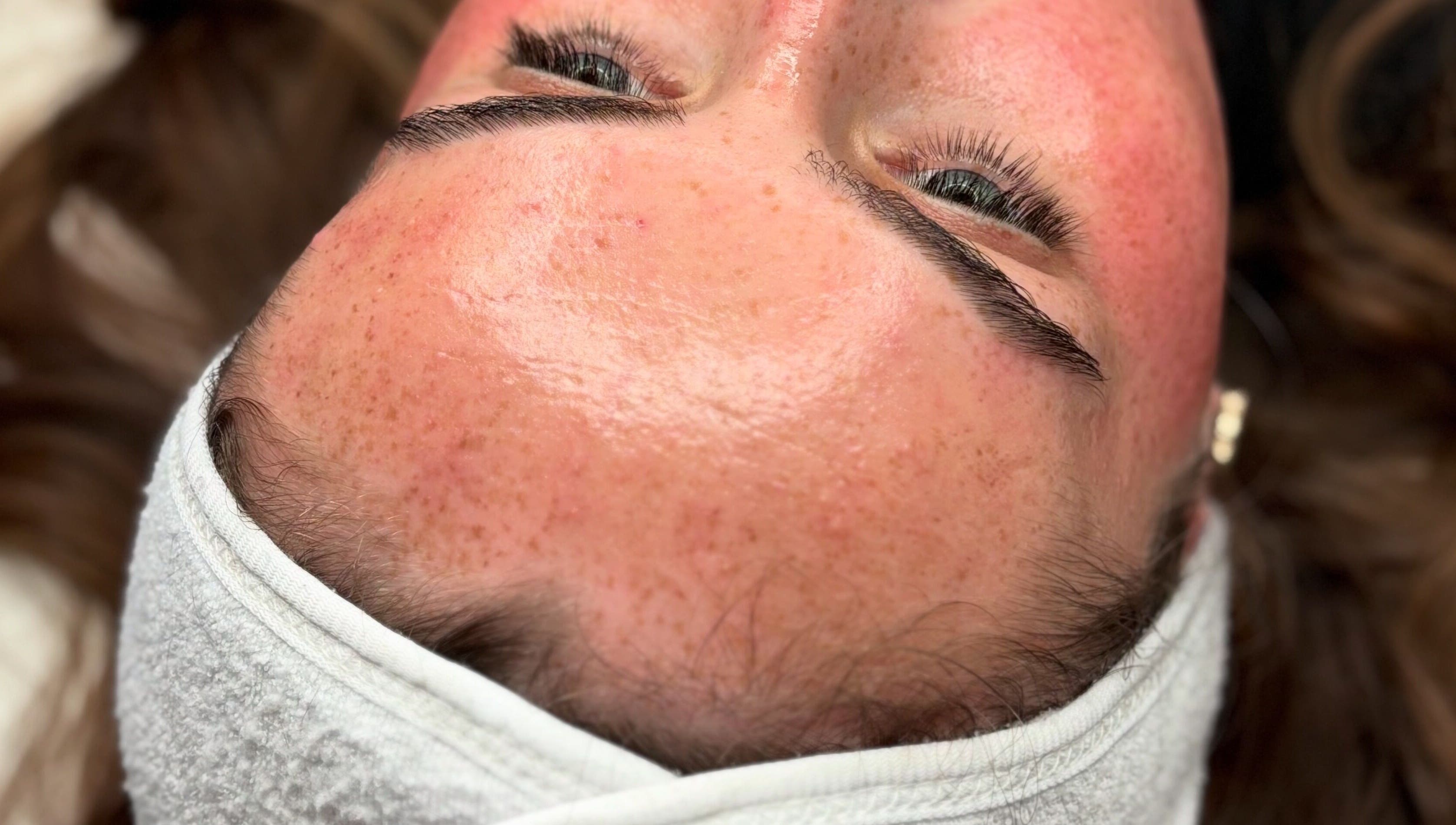 Close-up of a fresh facial treatment at Megan Bond Aesthetics, Astley Cross, England, GB.