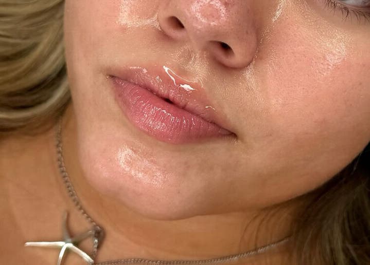 Close-up of glowing skin at Megan Bond Aesthetics, Astley Cross, England, GB showcasing beauty care results.