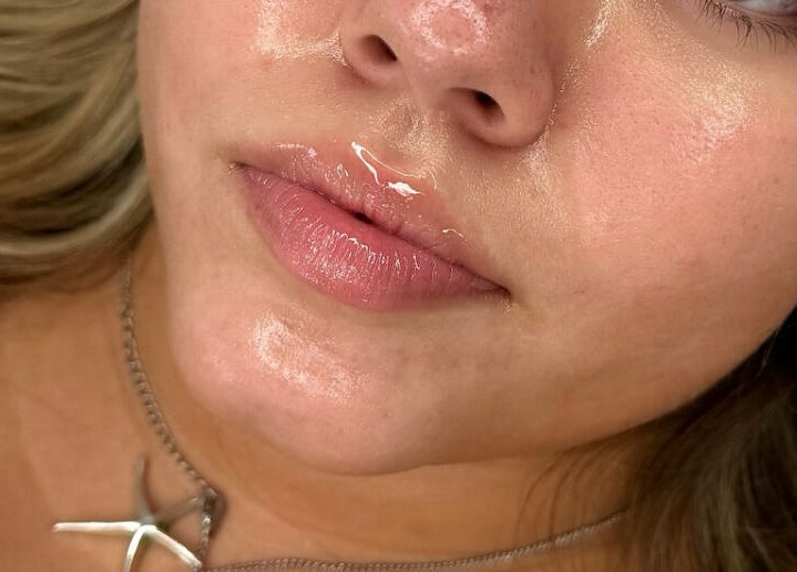 Close-up of glowing skin at Megan Bond Aesthetics, Astley Cross, England, GB showcasing beauty care results.