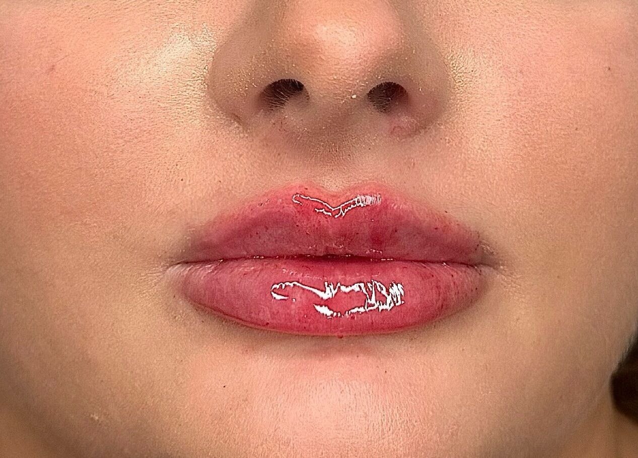 Glossy, enhanced lips showcased at Megan Bond Aesthetics, Astley Cross, England, GB post-treatment.