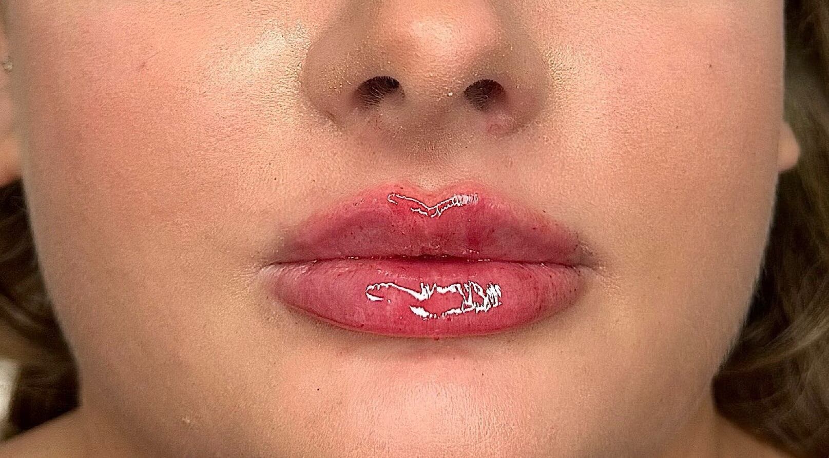 Glossy, enhanced lips showcased at Megan Bond Aesthetics, Astley Cross, England, GB post-treatment.