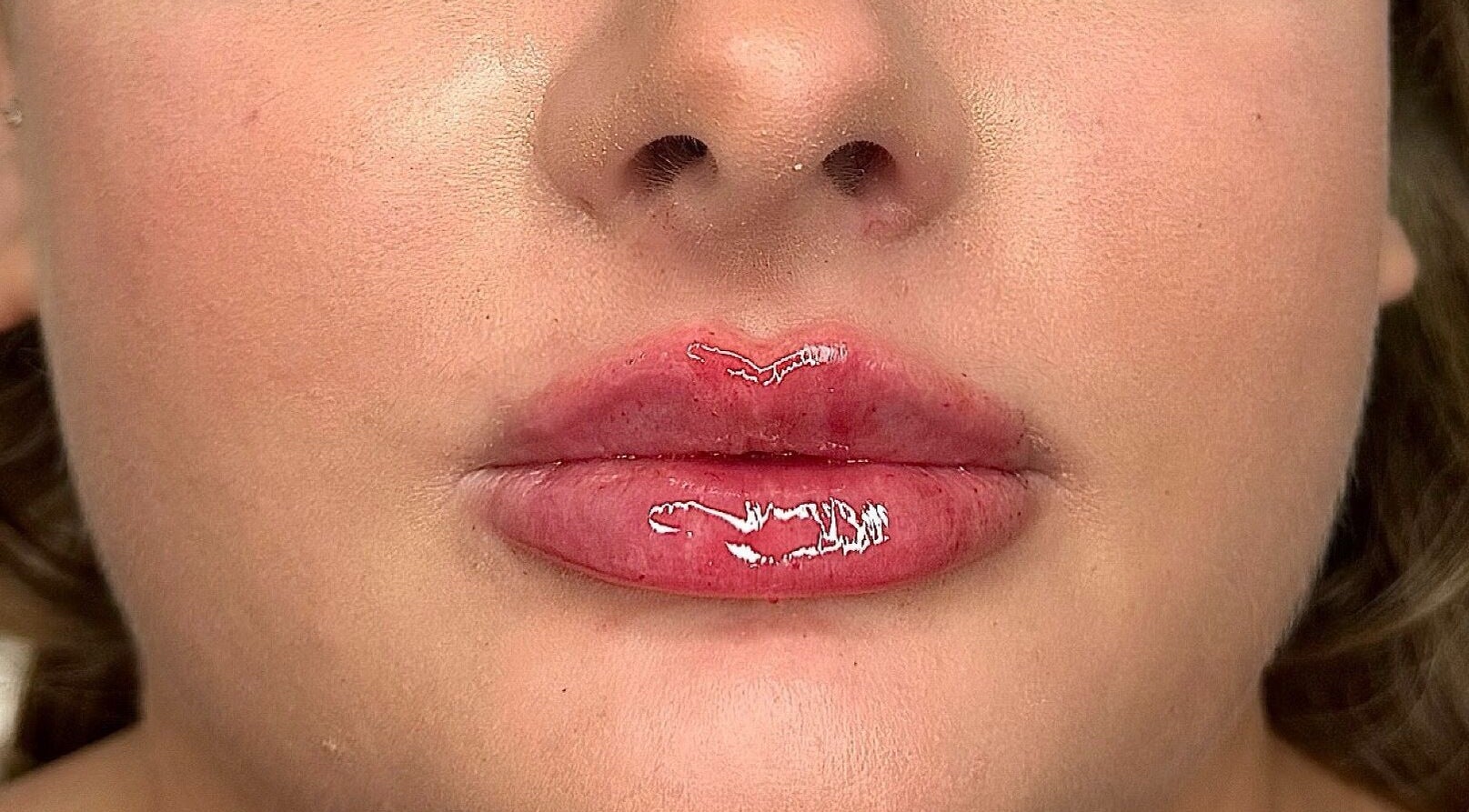 Glossy, enhanced lips showcased at Megan Bond Aesthetics, Astley Cross, England, GB post-treatment.