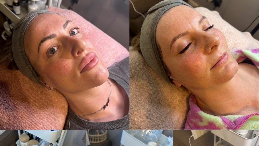 Lilypad Advanced Skincare and Aesthetics – kuva 1