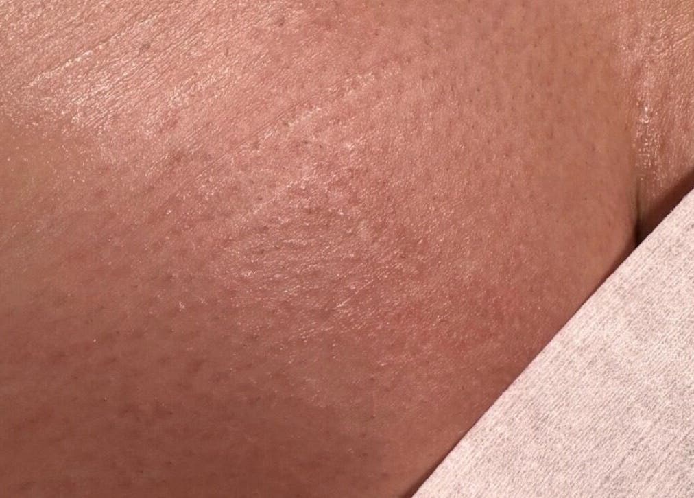 Smooth skin after waxing at Brow and Wax Studio, Birmingham, England, GB. Experience professional care and results.