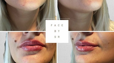 Face Aesthetics by SR image 3