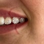 Byron Bay Tooth Gems and Whitening - 74 Centennial Circuit, 6, Byron Bay, New South Wales