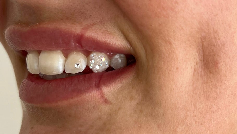 Byron Bay Tooth Gems and Whitening image 1