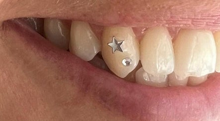 Byron Bay Tooth Gems and Whitening, bilde 2