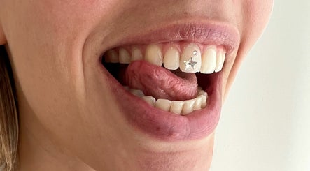 Byron Bay Tooth Gems and Whitening image 3