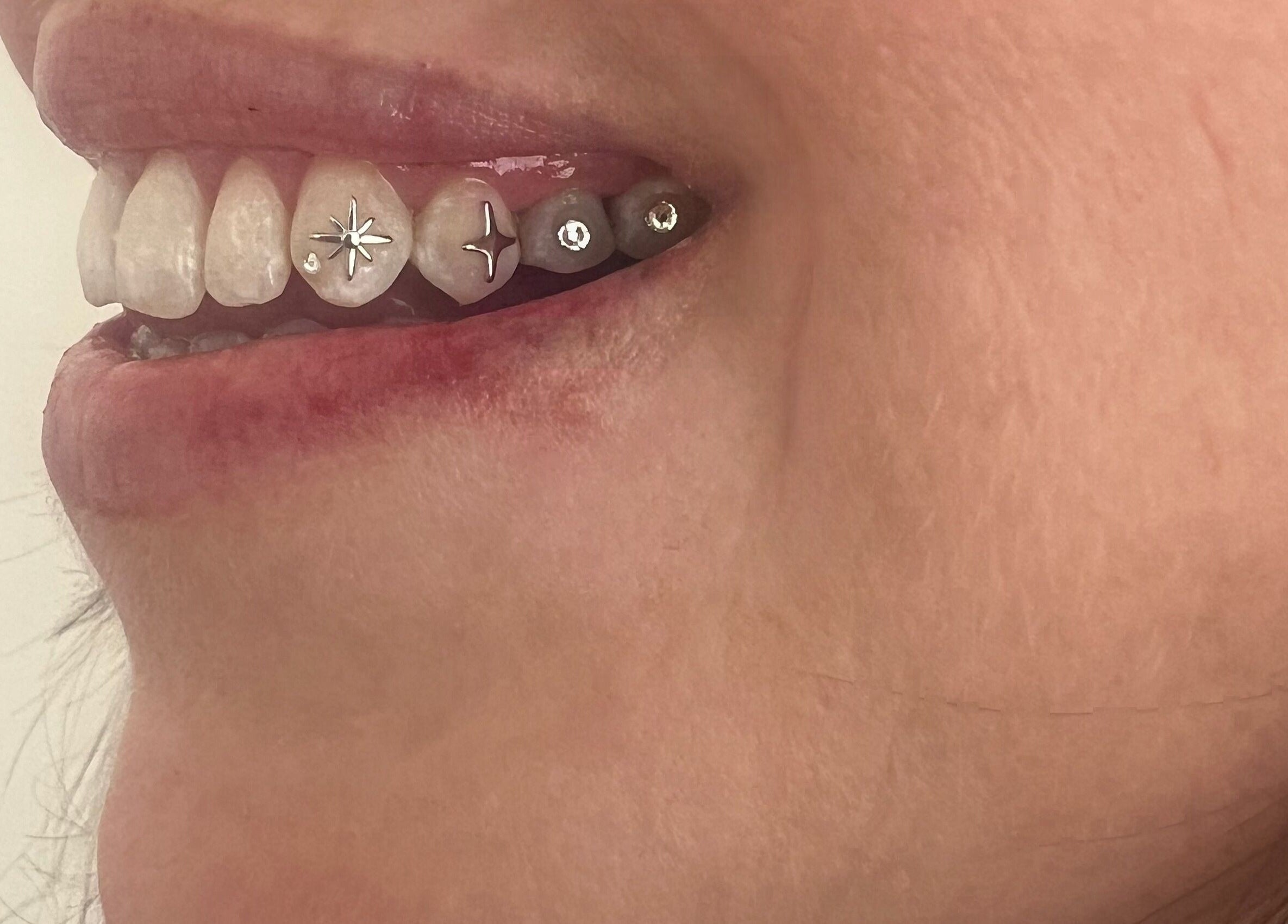 Close-up of a smiling mouth with tooth gems at Byron Bay Tooth Gems and Whitening, Byron Bay, New South Wales, AU.