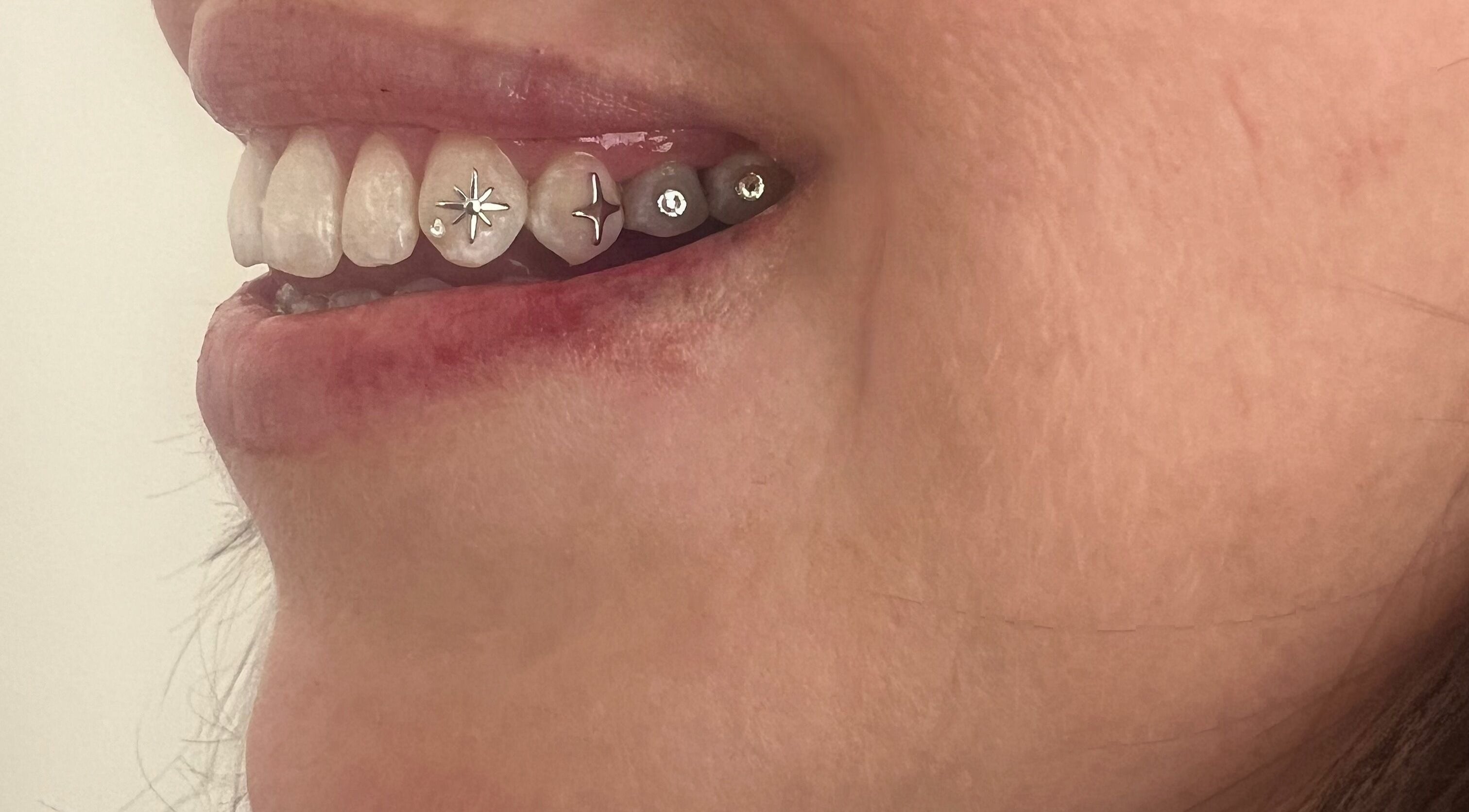 Close-up of a smiling mouth with tooth gems at Byron Bay Tooth Gems and Whitening, Byron Bay, New South Wales, AU.