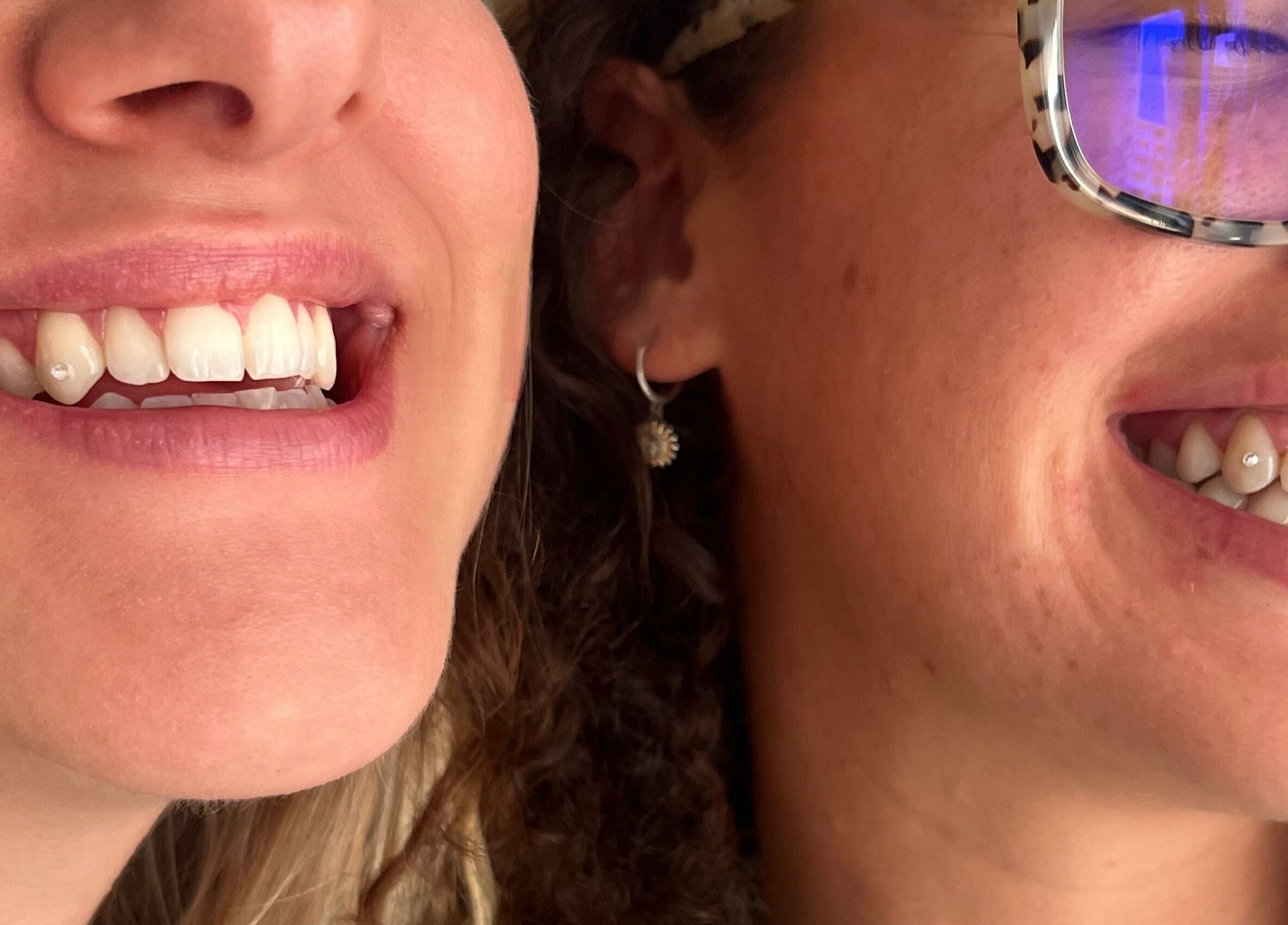 Two smiling women showcasing tooth gems at Byron Bay Tooth Gems and Whitening, Byron Bay, New South Wales, AU.