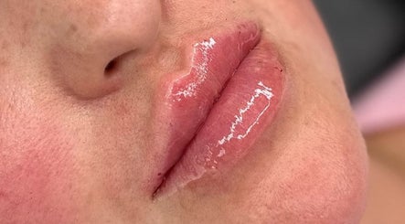 Glossed lips treatment at Leanne Jordan Beaute, Kingsteignton, England, GB showcasing beauty results.