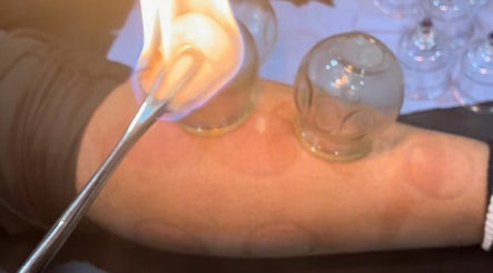 Herts Cupping - Hijama and Mix Massage image 2