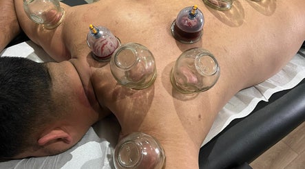 Herts Cupping - Hijama and Mix Massage image 3