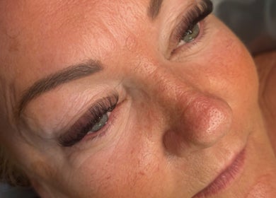 Close-up of rejuvenated skin at Hannaesthetics & Cosmetics, Ashton-in-makerfield, England, GB.