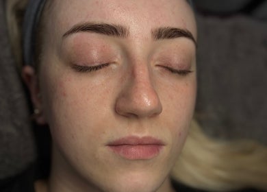 Close-up of serene face after treatment at Hannaesthetics & Cosmetics, Ashton-in-Makerfield, England, GB.