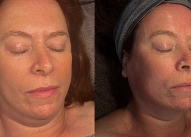 Facial treatment at Hannaesthetics & Cosmetics, Ashton-in-Makerfield, England, GB showing relaxed client.