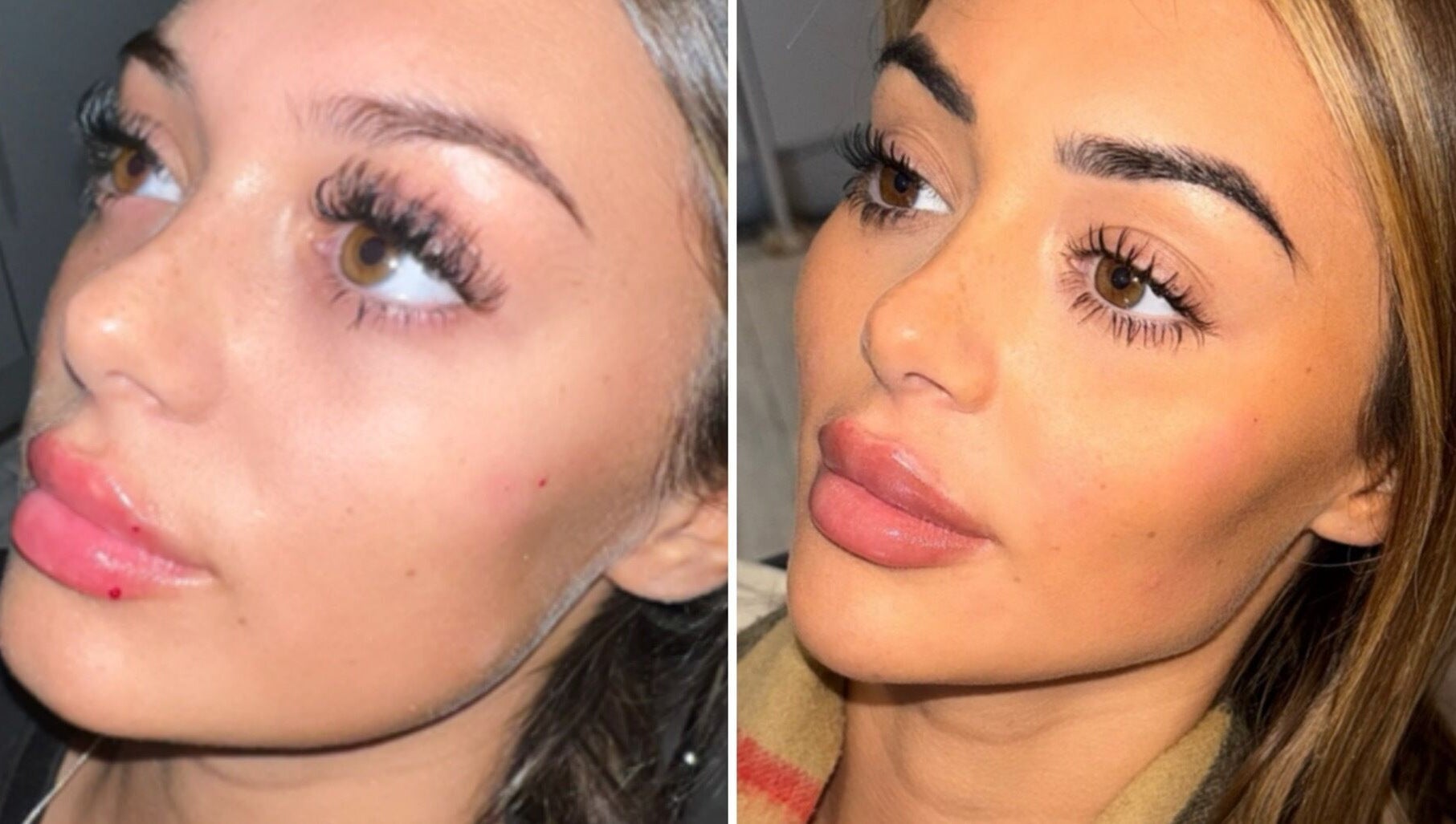 Close-up of a woman's enhanced eyelashes and lips at Aesthetics by Gemxx, Oldham, England, GB.