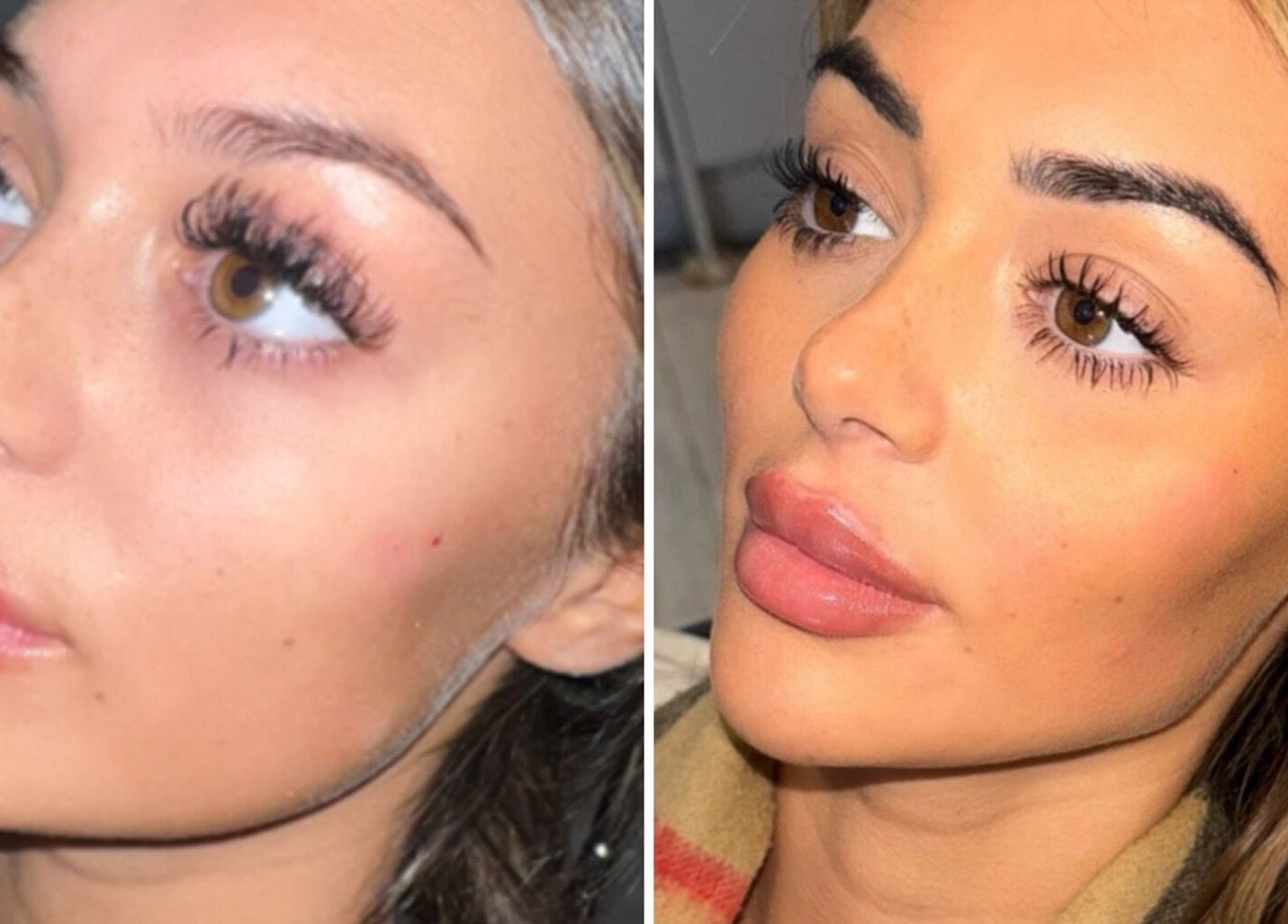 Close-up of a woman's enhanced eyelashes and lips at Aesthetics by Gemxx, Oldham, England, GB.