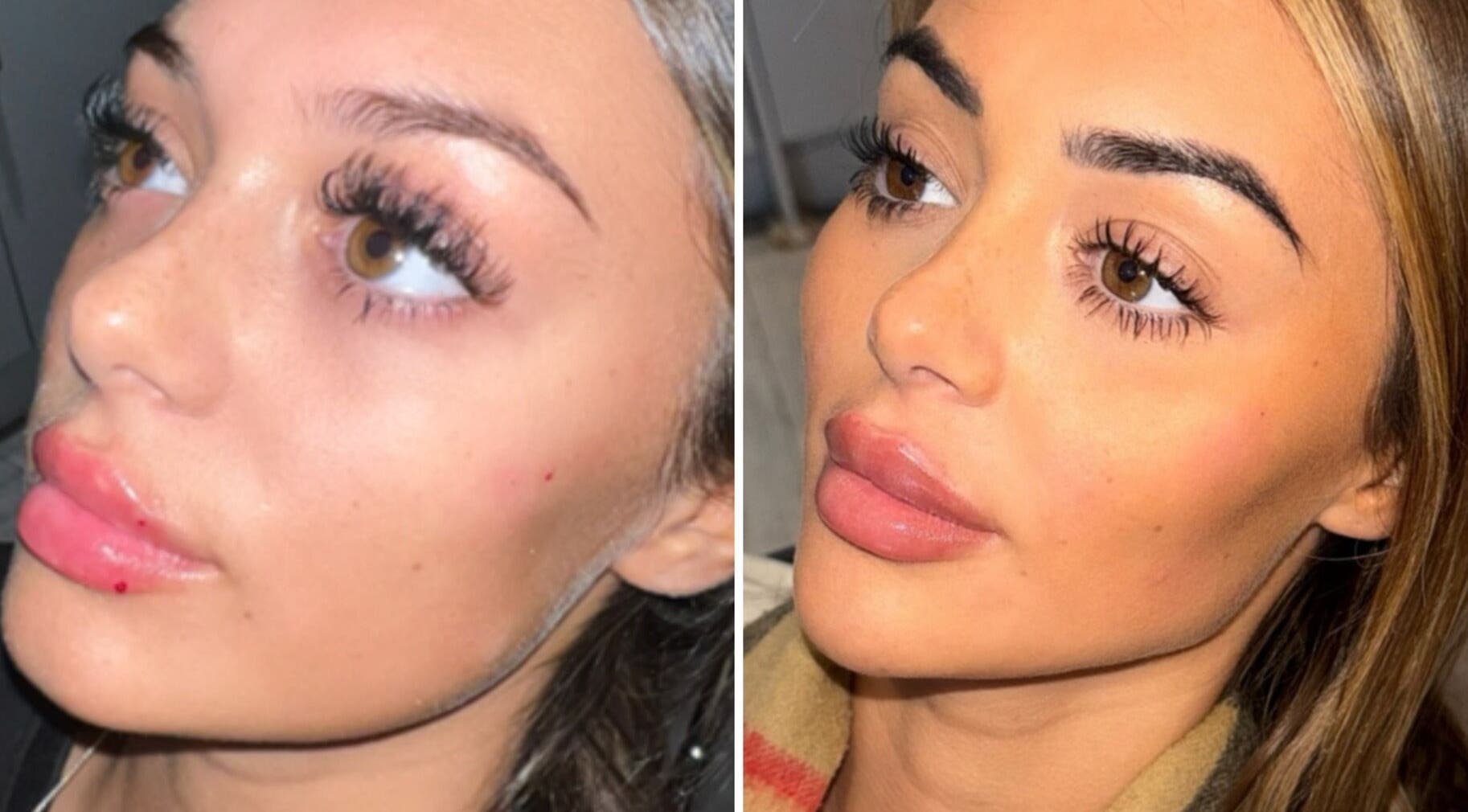 Close-up of a woman's enhanced eyelashes and lips at Aesthetics by Gemxx, Oldham, England, GB.