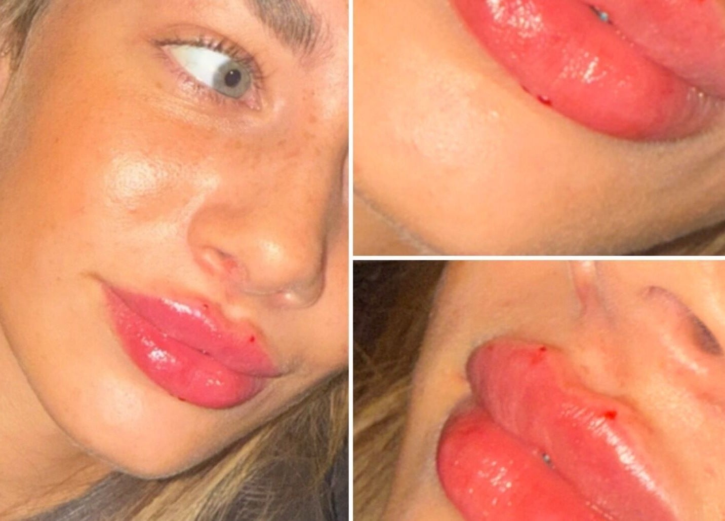 Close-up of glossy, full lips post-treatment at Aesthetics by Gemxx, Oldham, England, GB.