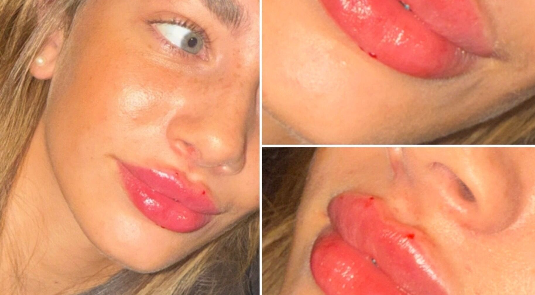 Close-up of glossy, full lips post-treatment at Aesthetics by Gemxx, Oldham, England, GB.