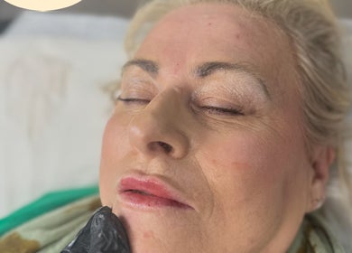 Client receiving treatment at PRETTY LITTLE FACES nurse led beauty clinic, Desborough, England, GB.