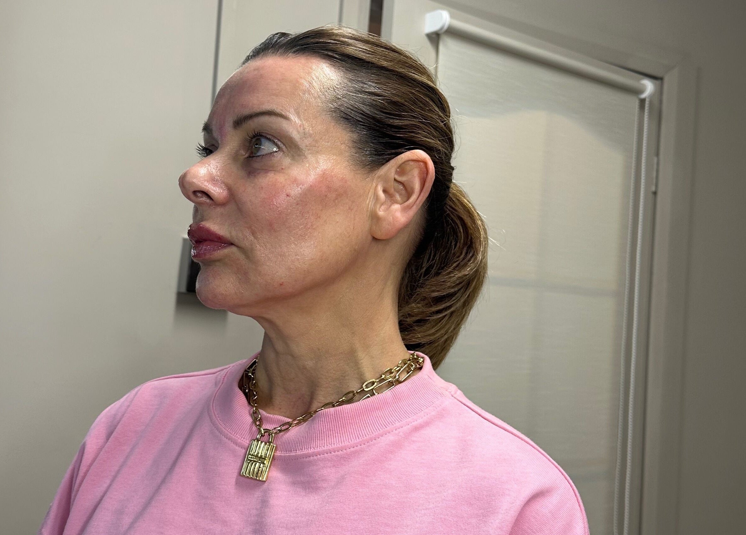 Client profile at PRETTY LITTLE FACES nurse led beauty clinic, Desborough, England, GB.