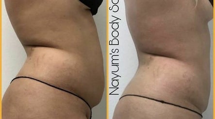 Nayums Body Sculpting afbeelding 3