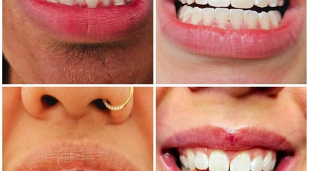 Sparkle Tooth Gem - Teeth Whitening And Tooth Gems зображення 2