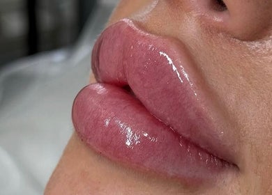 Glossy lips after treatment at The Skin Sanctuary, Limerick, County Limerick, IE.