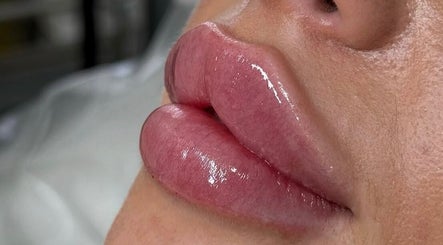 Glossy lips after treatment at The Skin Sanctuary, Limerick, County Limerick, IE.