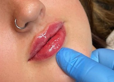 Close-up of glossy lips post-treatment at The Skin Sanctuary, Limerick, County Limerick, IE.