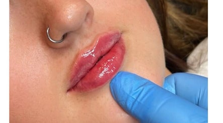 Close-up of glossy lips post-treatment at The Skin Sanctuary, Limerick, County Limerick, IE.