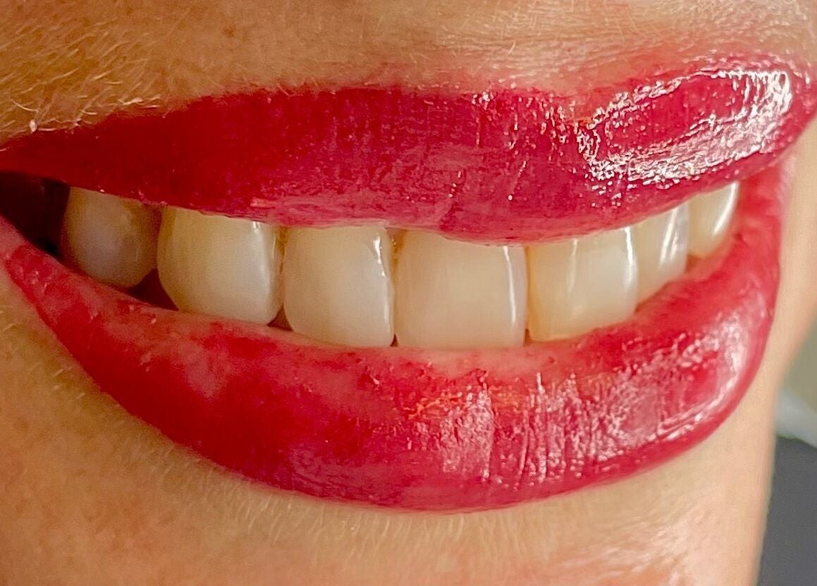 Close-up of red glossy lips and white teeth at I Beautify, Royal Tunbridge Wells, GB.