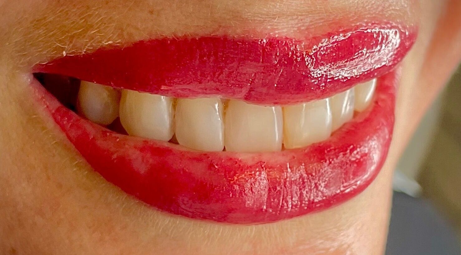 Close-up of red glossy lips and white teeth at I Beautify, Royal Tunbridge Wells, GB.