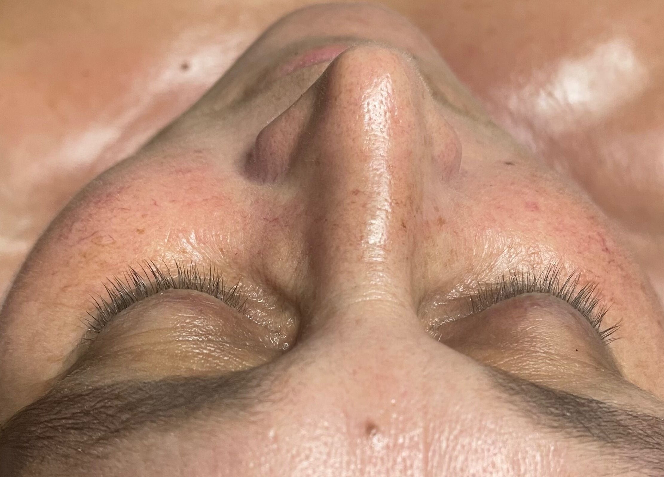 Close-up of a serene face post-treatment at Skin by Fran, Bath, England, GB, showcasing smooth, glowing skin.