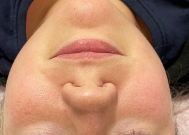 Close-up of a serene face during facial at U’niquely Touched by LJC in Celina, Texas, US.