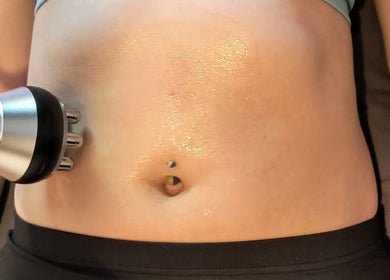 Body contouring treatment at Elevation Body Boost in Vancouver, British Columbia, CA.