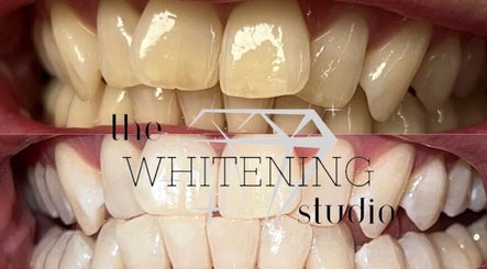 The Whitening Studio - Home Salon Bild 2