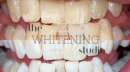 The Whitening Studio - Home Salon Bild 3