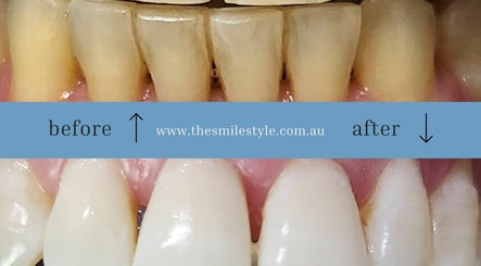 Εικόνα The Smile Style - Teeth Whitening Clinic - Tanunda 2