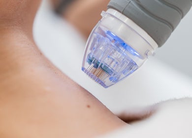 Professional skin treatment at Beauty by Kaja, Guyhirn, England, GB, using advanced technology.