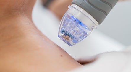 Professional skin treatment at Beauty by Kaja, Guyhirn, England, GB, using advanced technology.