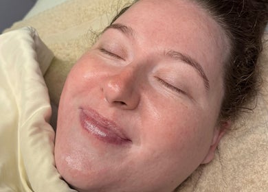 Relaxed woman enjoying beauty treatment at Sunshine Aesthetics, Roseville, Minnesota, US.