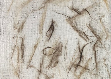 Close-up of fibers post-beauty treatment at Sunshine Aesthetics, Roseville, Minnesota, US.