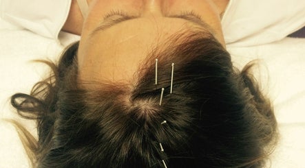 Origin Acupuncture Clinic - Miranda  billede 2